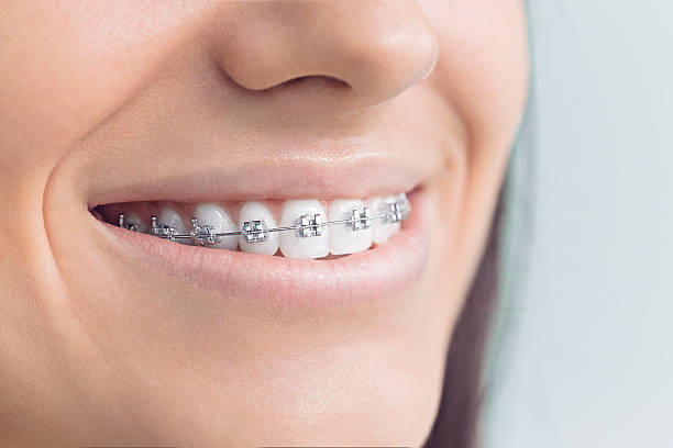 Best Veneers and Lumineers  in Rigby, ID